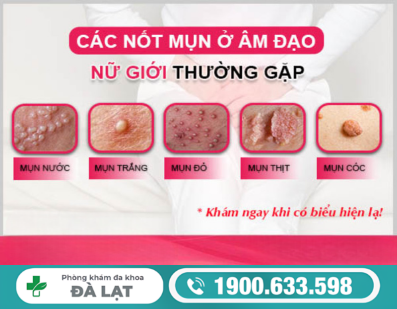 Hình ảnh minh họa